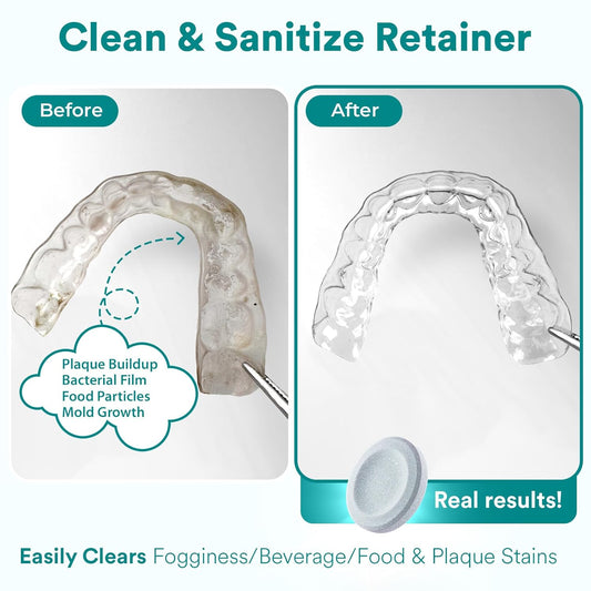 Weiss Naturals Retainer Cleaner Tablets, Invisalign Cleaner, Remove Stains, Odors & Plaque, PERSULFATE FREE Night Guard & Denture Cleaner 1-Month Supply, 30 Mint Scented Tablets