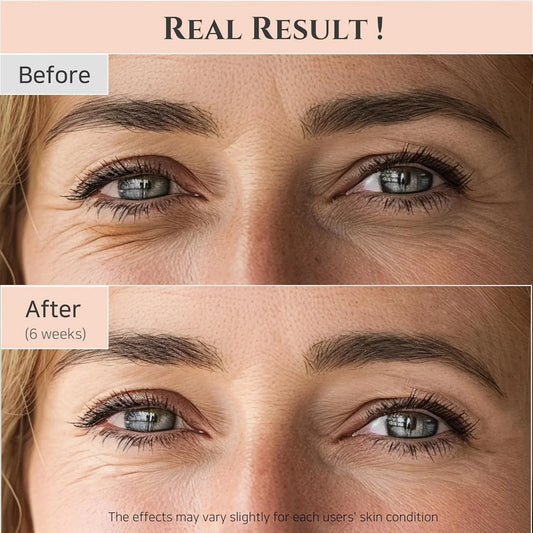 Joseon Revive Eye Serum with Retinal & Niacinamide for Puffy Eyes, Wrinkles, Dark Circles - Cart Shape