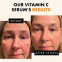 Eclat Skincare Vitamin C Serum - Skin Care for Dark Spots, Vitamin C Serum for Face with Hyaluronic Acid, Ferulic Acid, & Vit E - Anti Aging and Skin Brightening Vit C Formula for Face Care 1 Fl Oz