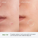 MAREE Pimple Patches for Face - Acne Clearing Device - Clear Acne Patches for Face - Invisible Hydrocolloid Patch Parches Para Acne Stickers Zit Dots - Cystic Zit Healing Blemish Pinple Covers