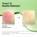 Anua Azelaic Acid 10 Hyaluron Redness Soothing Serum, Facial Serum for Sensitive skin, Hyaluronic Acid, Niacinamide, Spot Care, Natural Color, Vegan, Korean Skincare (30ml/ 1.01 fl oz.)